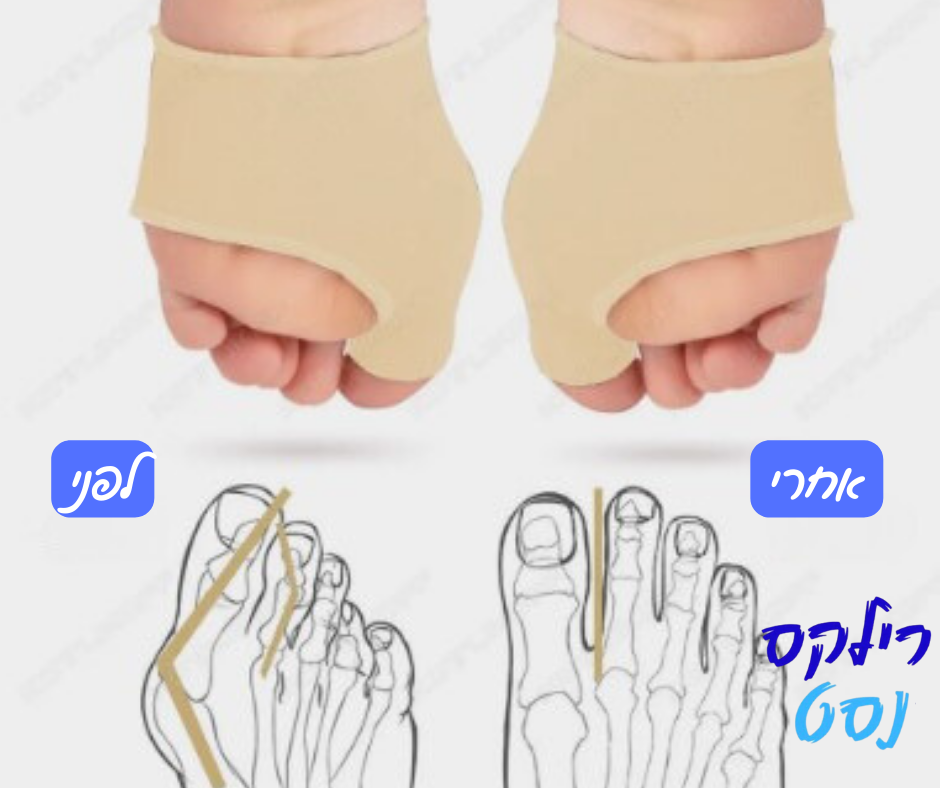 מפריד בוהן אורטופדי להקלת כאבים ושחזור צורת הרגל